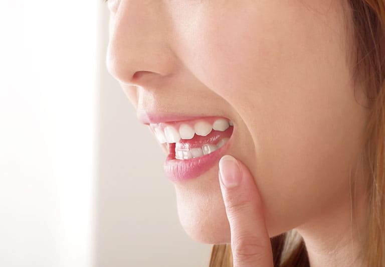 「前歯だけ」も可能な、ライフスタイルに寄り添う部分矯正