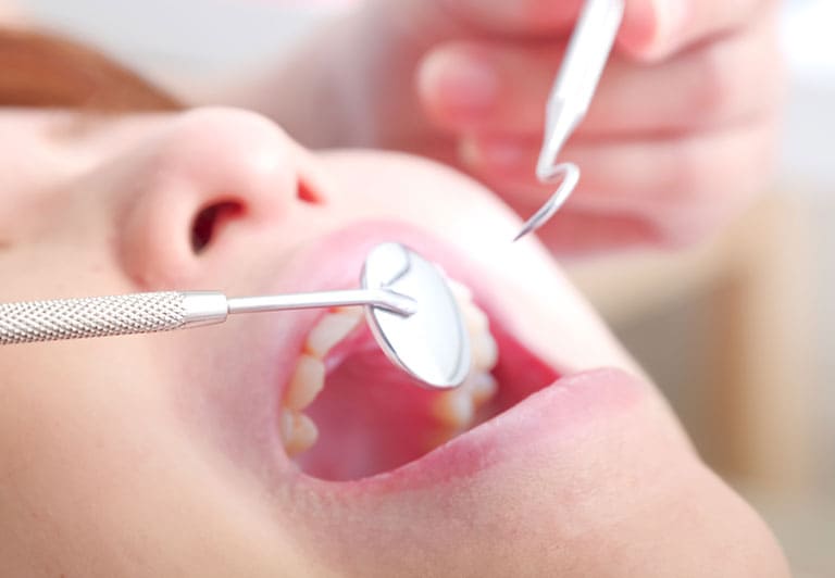 「守るために通う」予防を重視した歯科習慣