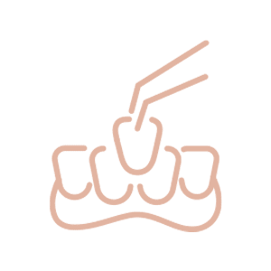 被せ物・入れ歯治療